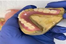 دندان سازی لبخند در یزد، بهترین دندان مصنوعی در یزد(دندان سازی)، ساخت تخصصی دندان مصنوعی ژله ای در یزد، ساخت باکیفیت ترین دندان های مصنوعی در یزد
