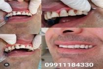 دنتال شهاب در شیراز shahab_dental.shiraz