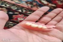 دندانسازی در تربت حیدریه