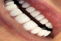 کلینیک دندانپزشکی دکتر احسان علی پناهی در شیراز، بهترین خدمات ترمیم و زیبایی دندان در شیراز، خدمات دندانپزشکی در بلوار سفیر شیراز، خدمات ونیرکامپوزیت در شیراز، بهترین خدمات عصب کشی و ترمیم در شیراز