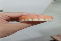 دندانسازی تخصصی مهدوی در همدان، بهترین دندانسازی در همدان، دندانسازی ارزان و قسطی در همدان، ساخت دندان مصنوعی در همدان، دندانسازی با کیفیت و تضمینی در همدان، دندانساز تجربی در همدان